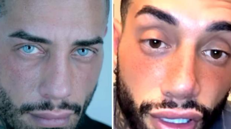francesco chiofalo cambia colore degli occhi insultato dagli haters